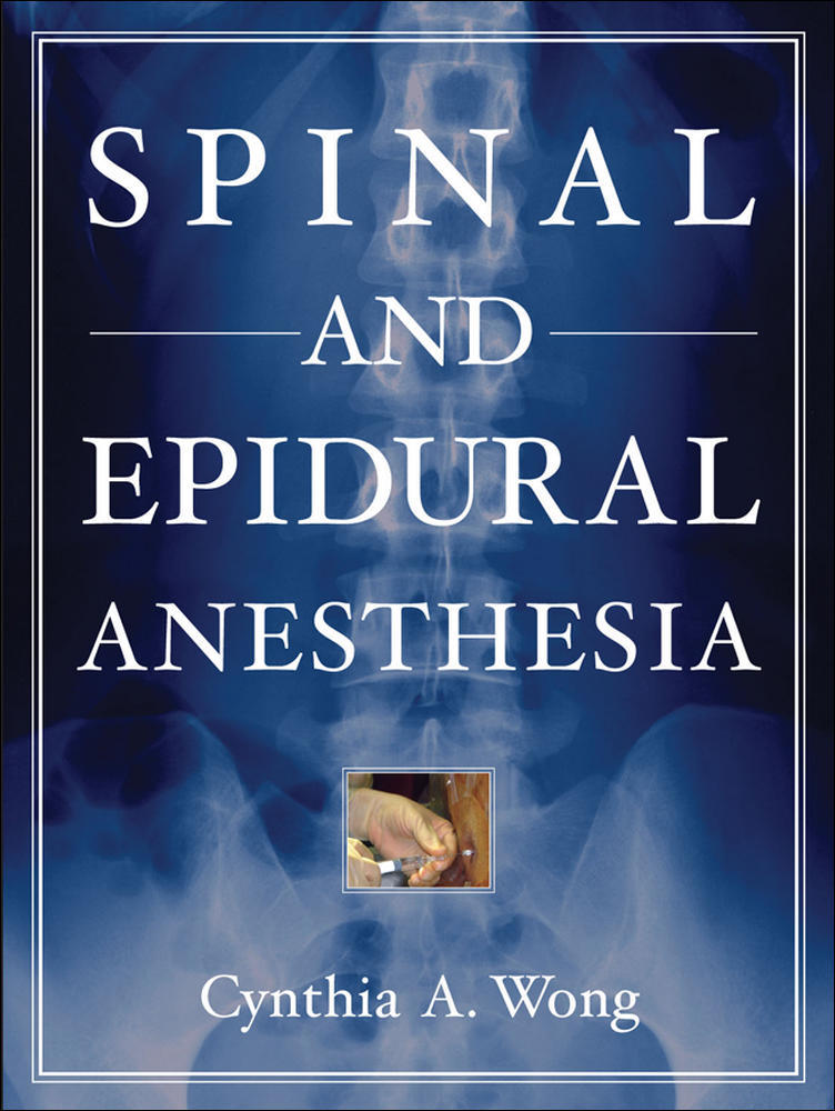 Spinal and Epidural Anesthesia | Zookal Textbooks | Zookal Textbooks