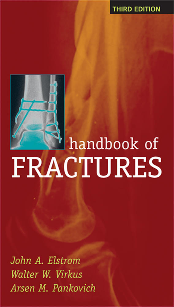 Handbook of Fractures, Third Edition | Zookal Textbooks | Zookal Textbooks
