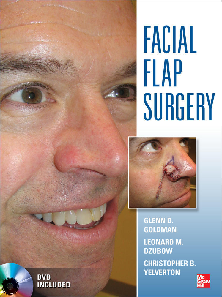 Facial Flaps Surgery | Zookal Textbooks | Zookal Textbooks
