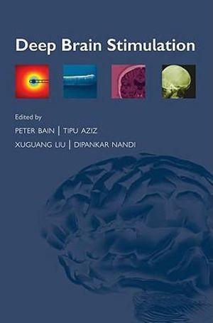 Deep Brain Stimulation | Zookal Textbooks | Zookal Textbooks