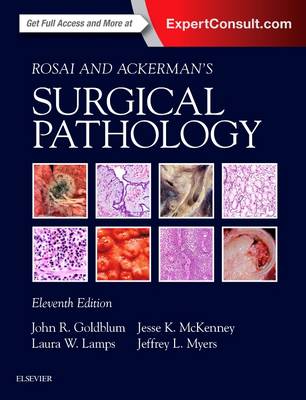 Rosai and Ackerman's Surgical Pathology - 2 Volume Set | Zookal Textbooks | Zookal Textbooks