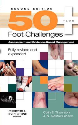 50+ Foot Challenges, Second Edition | Zookal Textbooks | Zookal Textbooks