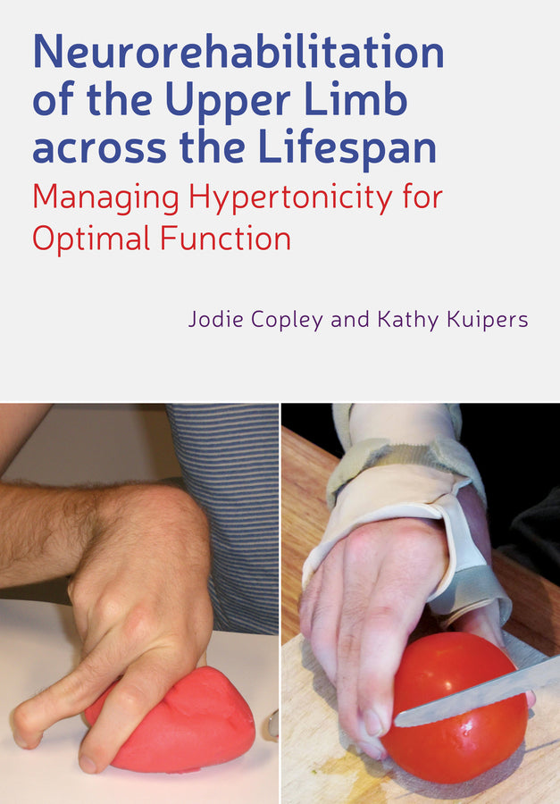 Neurorehabilitation of the Upper Limb Across the Lifespan | Zookal Textbooks | Zookal Textbooks