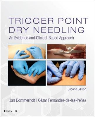 Trigger Point Dry Needling: An Evidence and Clinical-Based Approach | Zookal Textbooks | Zookal Textbooks