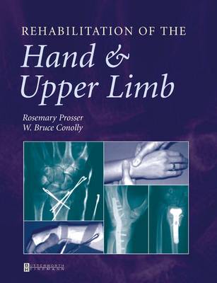 Rehabilitation of the Hand and Upper Limb | Zookal Textbooks | Zookal Textbooks