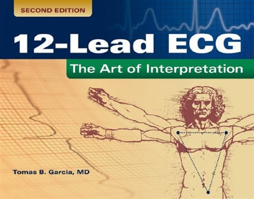 12-lead ECG | Zookal Textbooks | Zookal Textbooks