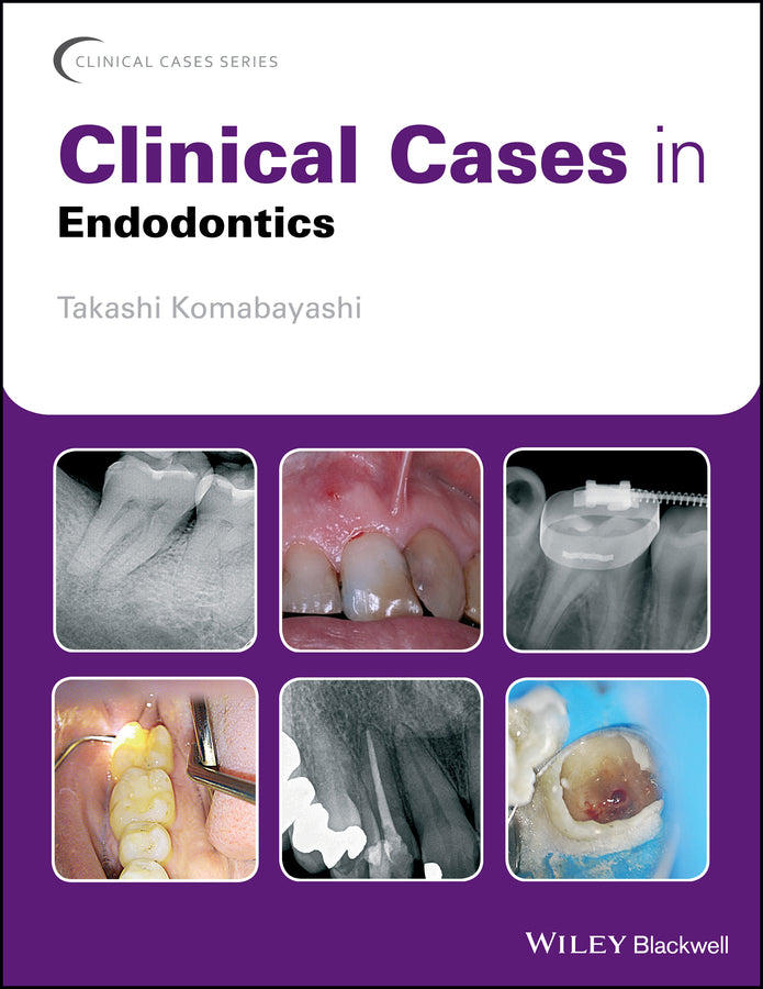 Clinical Cases in Endodontics | Zookal Textbooks | Zookal Textbooks