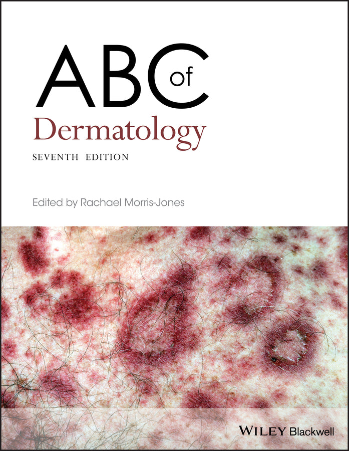 ABC of Dermatology | Zookal Textbooks | Zookal Textbooks