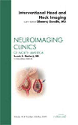 Interventional Head and Neck, An Issue of Neuroimaging Clinics | Zookal Textbooks | Zookal Textbooks