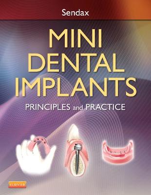 Mini Dental Implants: Principles and Practices 1e | Zookal Textbooks | Zookal Textbooks