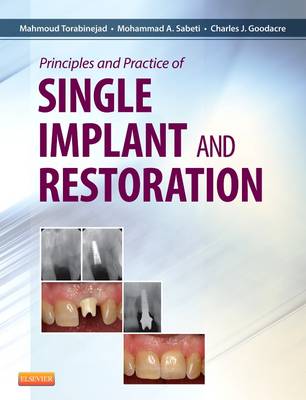 Principles and Practice Single Implant and Restorations 1e | Zookal Textbooks | Zookal Textbooks