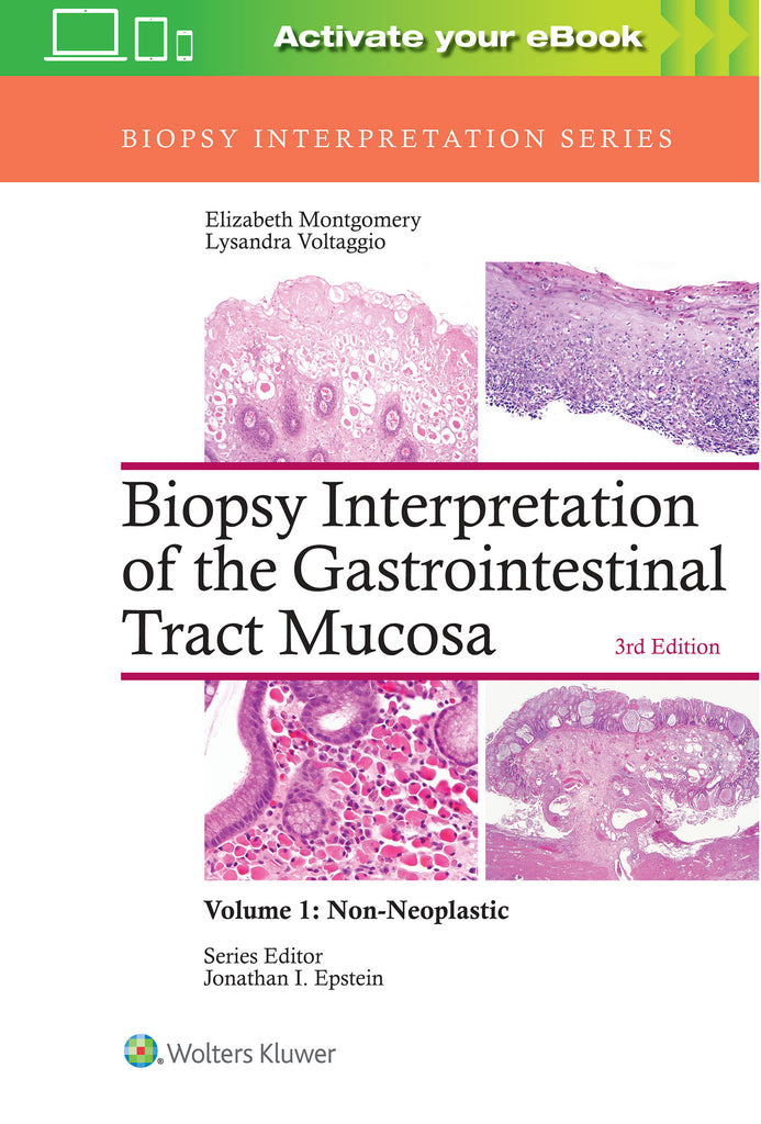 Biopsy Interpretation of the Gastrointestinal Tract Mucosa:     Volume 1: Non-Neoplastic | Zookal Textbooks | Zookal Textbooks