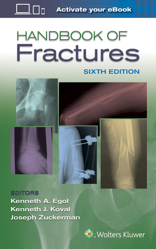 Handbook of Fractures | Zookal Textbooks | Zookal Textbooks