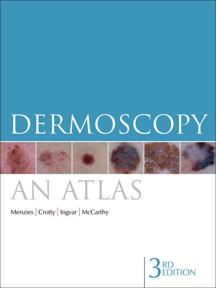 Dermoscopy: An Atlas, 3rd Edition | Zookal Textbooks | Zookal Textbooks