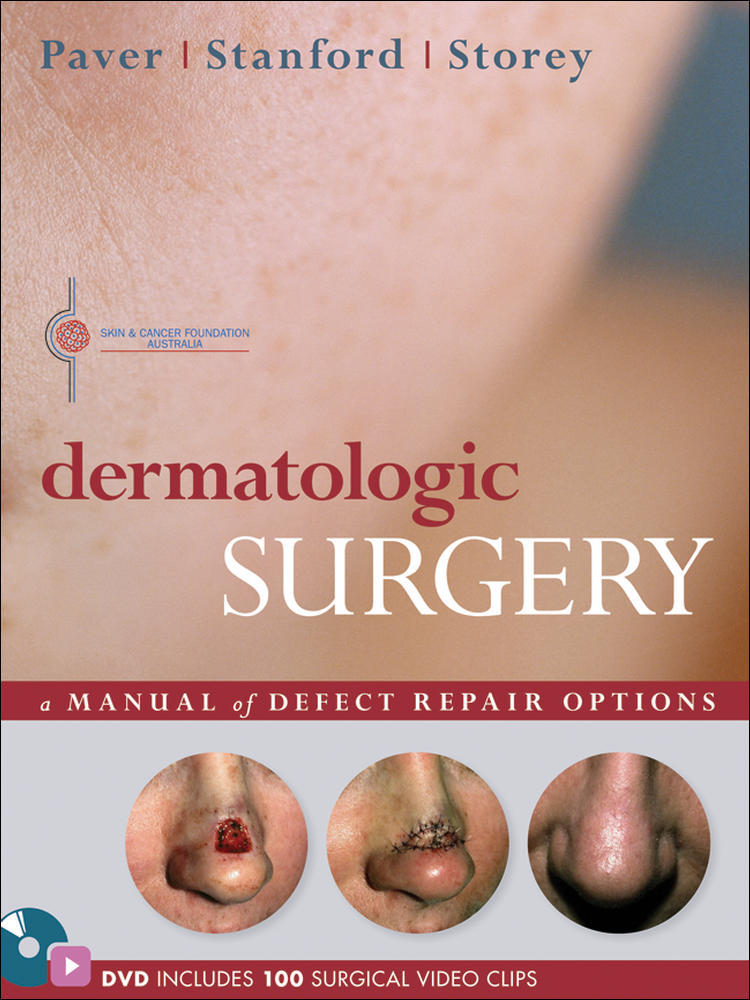 Dermatologic Surgery | Zookal Textbooks | Zookal Textbooks