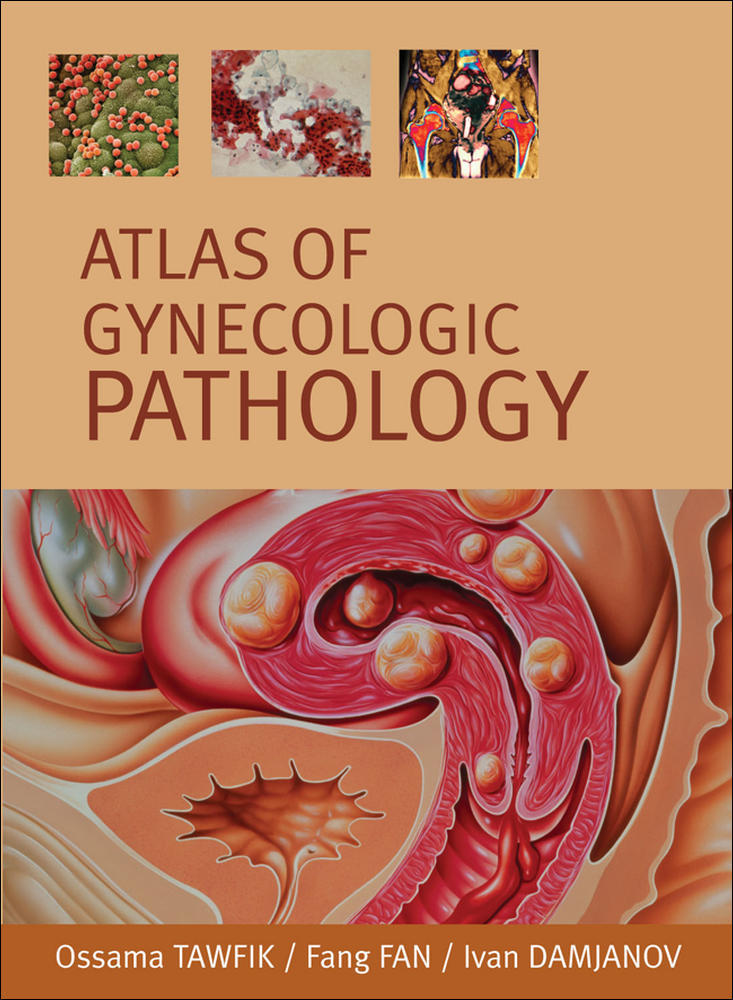Atlas of Gynecological Pathology | Zookal Textbooks | Zookal Textbooks