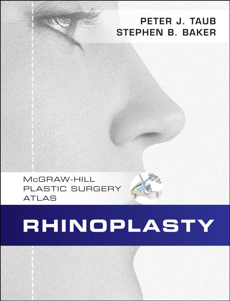 Rhinoplasty | Zookal Textbooks | Zookal Textbooks