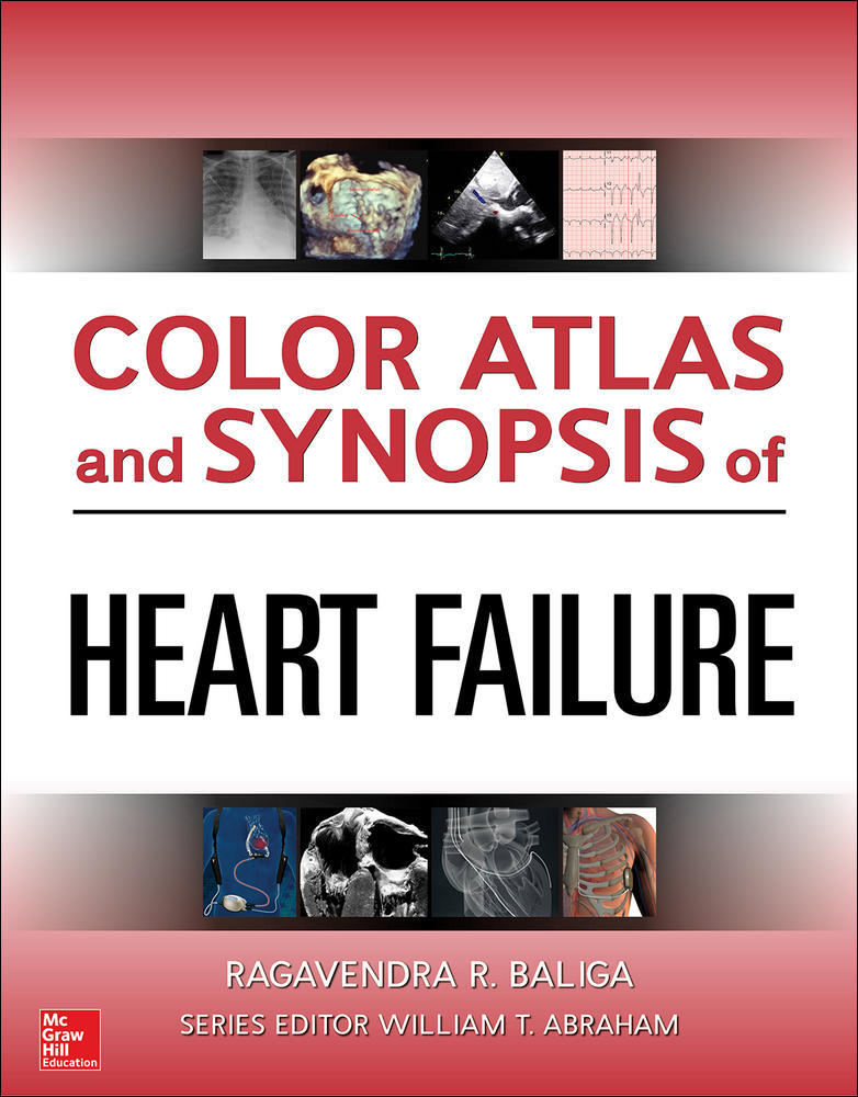 Color Atlas and Synopsis of Heart Failure | Zookal Textbooks | Zookal Textbooks