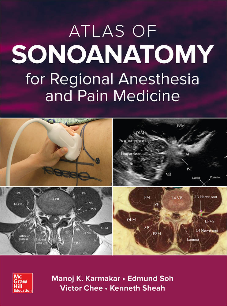 Atlas of Sonoanatomy for Regional Anesthesia and Pain Medicine | Zookal Textbooks | Zookal Textbooks