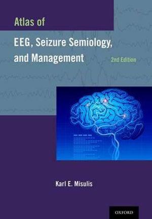 Atlas of EEG, Seizure Semiology, and Management | Zookal Textbooks | Zookal Textbooks