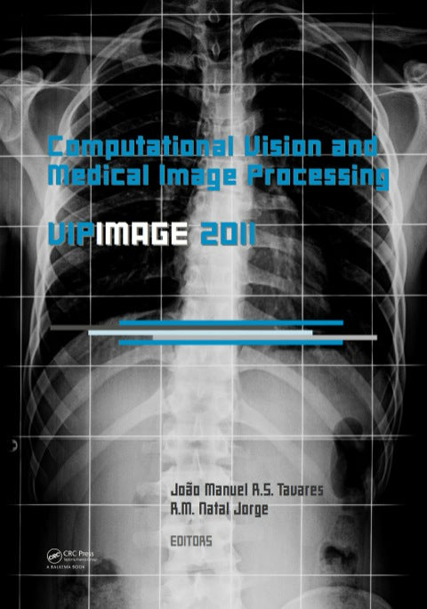 Computational Vision and Medical Image Processing: VipIMAGE 2011 | Zookal Textbooks | Zookal Textbooks