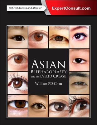 Asian Blepharoplasty and the Eyelid Crease 3E | Zookal Textbooks | Zookal Textbooks
