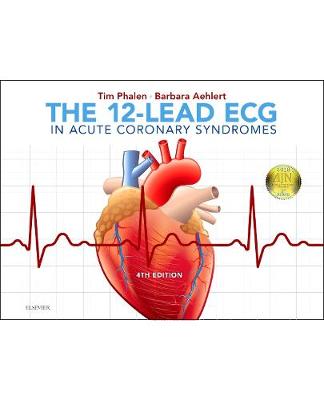 The 12-Lead ECG in Acute Coronary Syndromes | Zookal Textbooks | Zookal Textbooks
