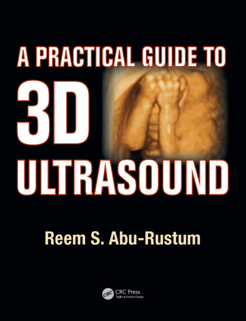 A Practical Guide to 3D Ultrasound | Zookal Textbooks | Zookal Textbooks