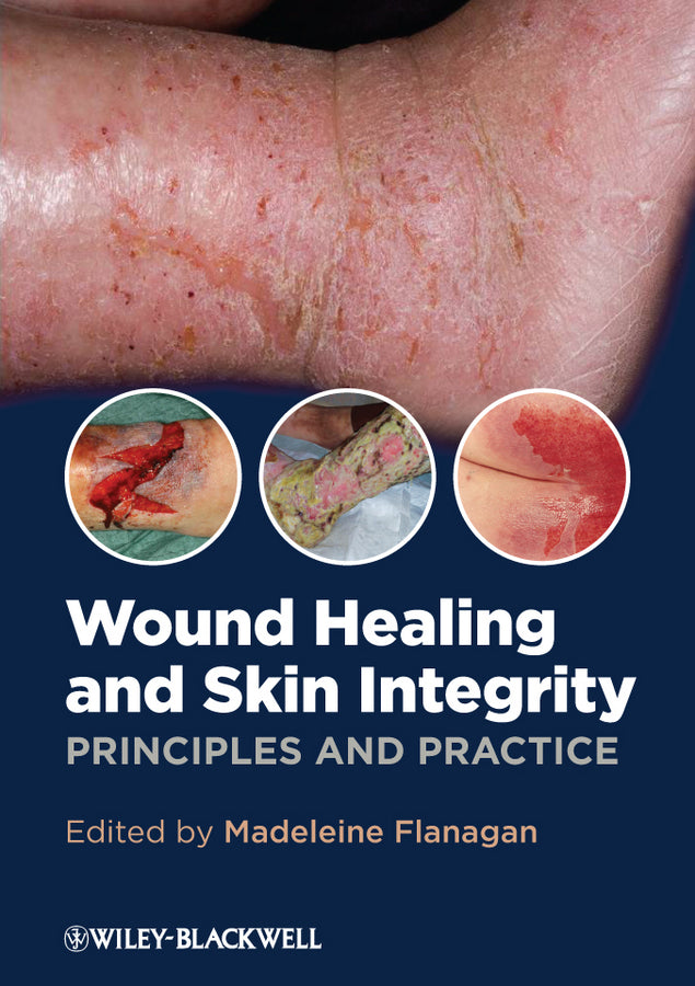 Wound Healing and Skin Integrity | Zookal Textbooks | Zookal Textbooks