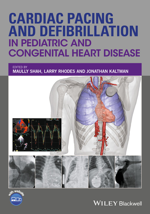 Cardiac Pacing and Defibrillation in Pediatric and Congenital Heart Disease | Zookal Textbooks | Zookal Textbooks