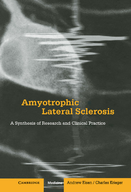 Amyotrophic Lateral Sclerosis | Zookal Textbooks | Zookal Textbooks
