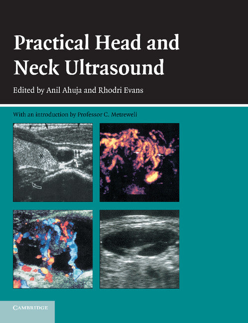 Practical Head and Neck Ultrasound | Zookal Textbooks | Zookal Textbooks