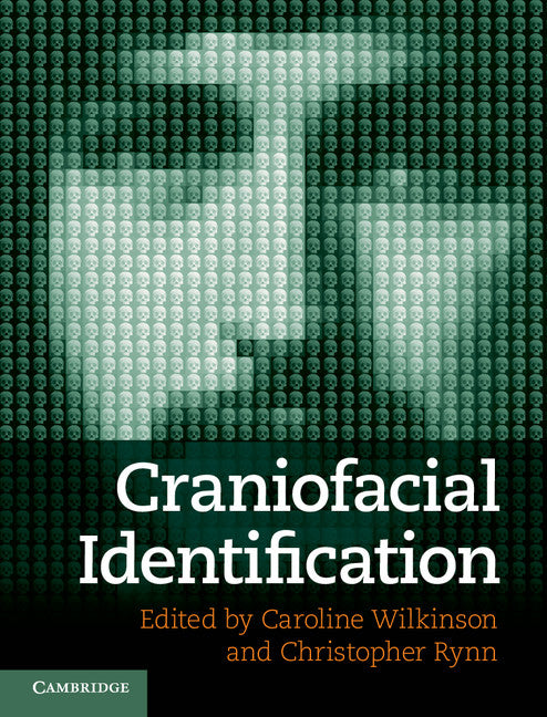 Craniofacial Identification | Zookal Textbooks | Zookal Textbooks