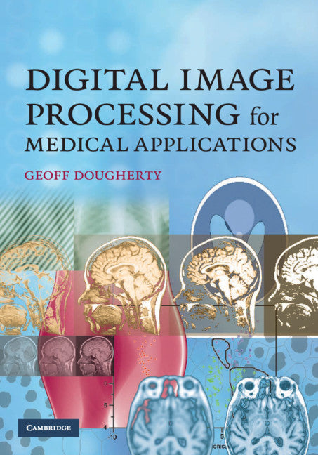 Digital Image Processing for Medical Applications | Zookal Textbooks | Zookal Textbooks