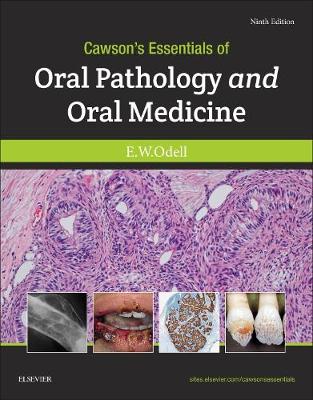 Cawson's Essentials of Oral Pathology and Oral Medicine 9E | Zookal Textbooks | Zookal Textbooks