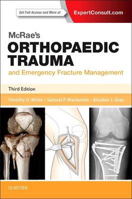 McRae's Pocketbook of Orthopaedic Trauma and Emergency Fracture Management | Zookal Textbooks | Zookal Textbooks
