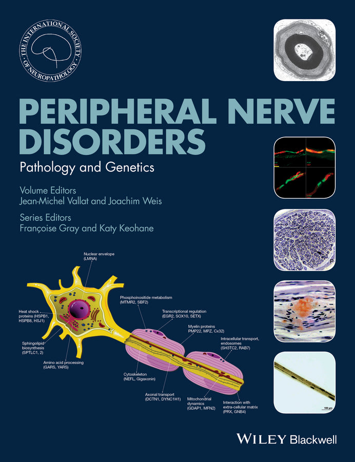 Peripheral Nerve Disorders | Zookal Textbooks | Zookal Textbooks