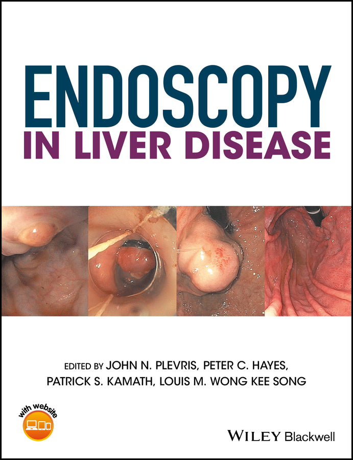 Endoscopy in Liver Disease | Zookal Textbooks | Zookal Textbooks