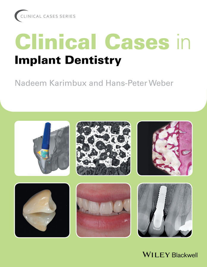 Clinical Cases in Implant Dentistry | Zookal Textbooks | Zookal Textbooks