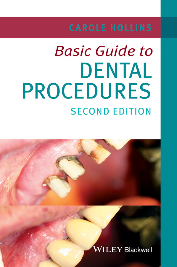 Basic Guide to Dental Procedures | Zookal Textbooks | Zookal Textbooks