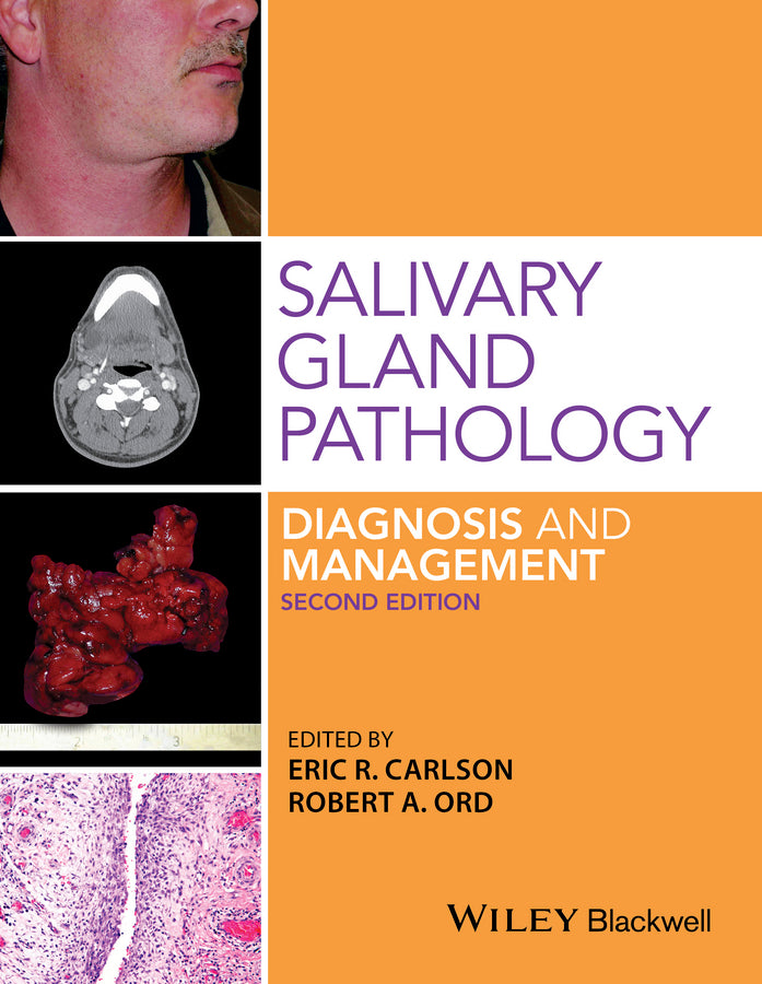 Salivary Gland Pathology | Zookal Textbooks | Zookal Textbooks