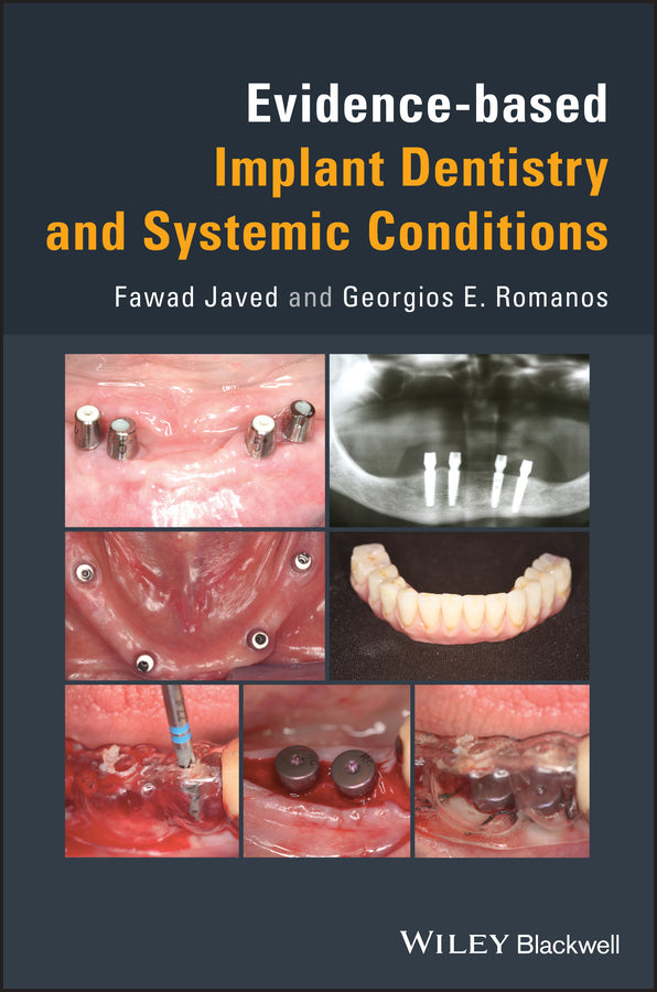 Evidence-based Implant Dentistry and Systemic Conditions | Zookal Textbooks | Zookal Textbooks