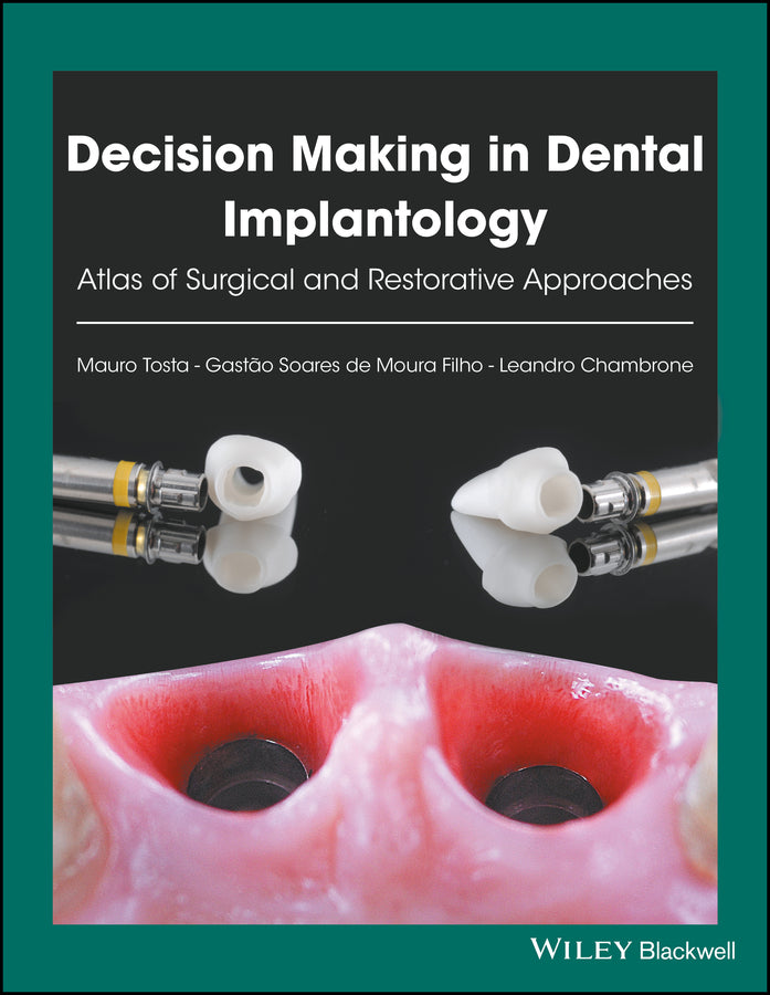 Decision Making in Dental Implantology | Zookal Textbooks | Zookal Textbooks