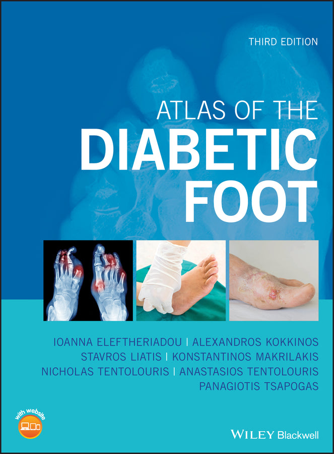 Atlas of the Diabetic Foot | Zookal Textbooks | Zookal Textbooks