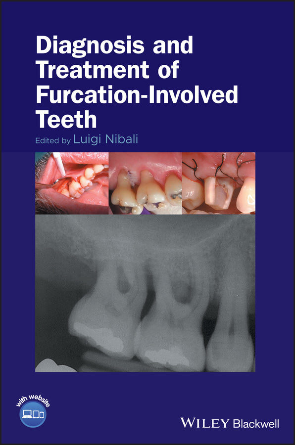 Diagnosis and Treatment of Furcation-Involved Teeth | Zookal Textbooks | Zookal Textbooks