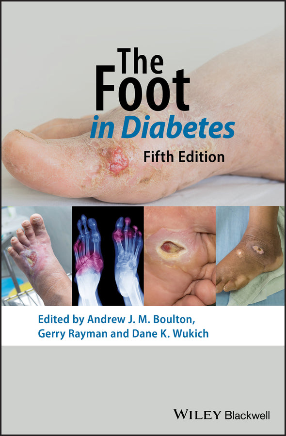 The Foot in Diabetes | Zookal Textbooks | Zookal Textbooks