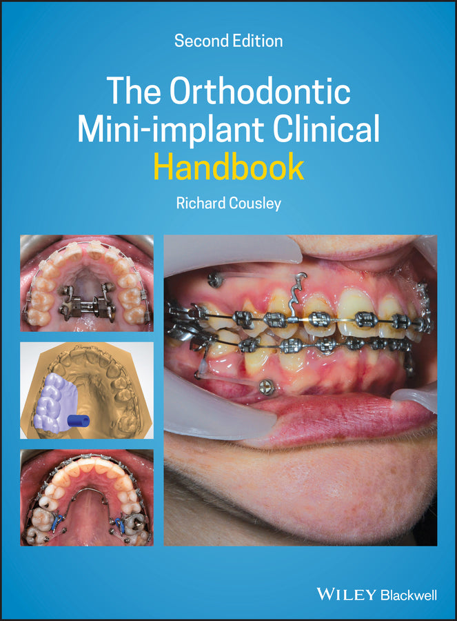 The Orthodontic Mini-implant Clinical Handbook | Zookal Textbooks | Zookal Textbooks