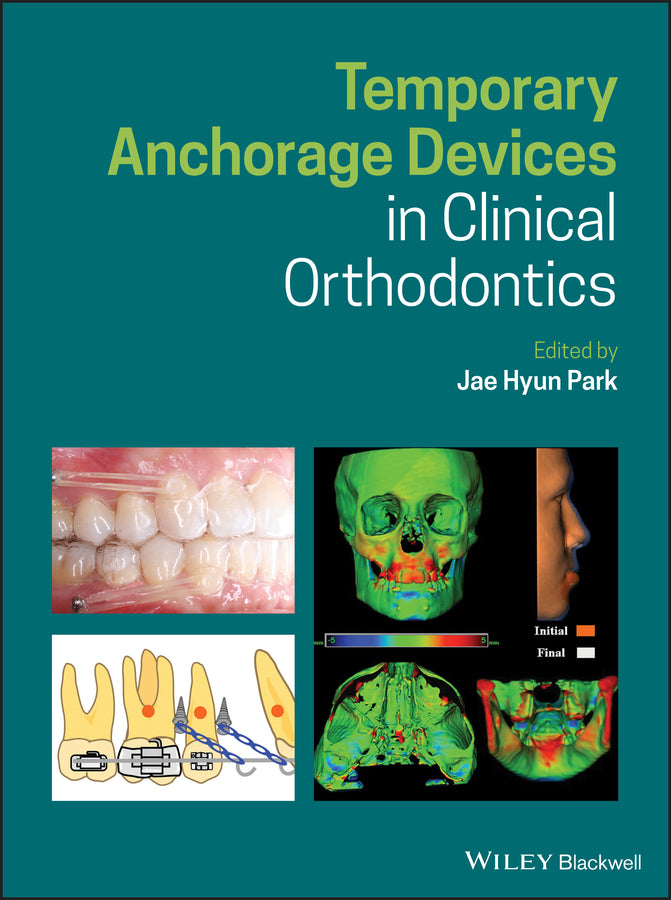 Temporary Anchorage Devices in Clinical Orthodontics | Zookal Textbooks | Zookal Textbooks