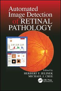 Automated Image Detection of Retinal Pathology | Zookal Textbooks | Zookal Textbooks