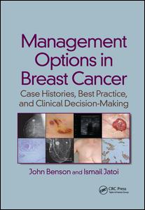 Management Options in Breast Cancer | Zookal Textbooks | Zookal Textbooks